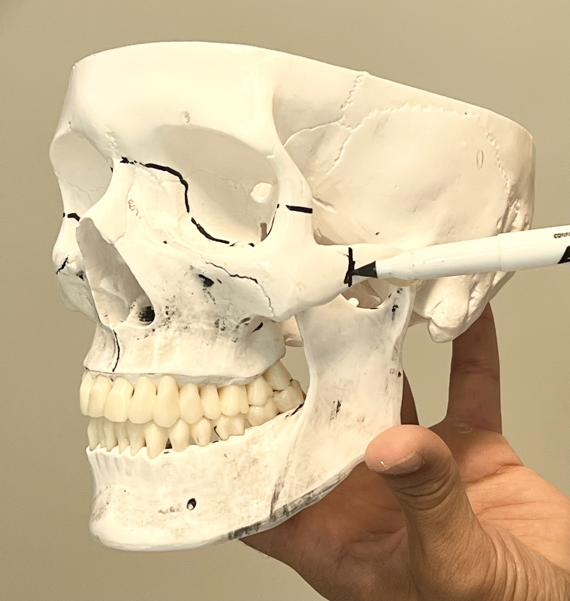 Human Skull.
