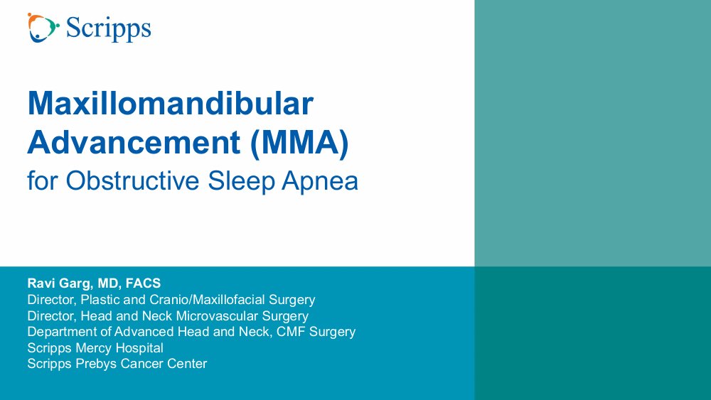 Cover of the Maxillomandibular Advancement for Obstructive Sleep Apnea guide by Ravi Garg, MD, FACS.